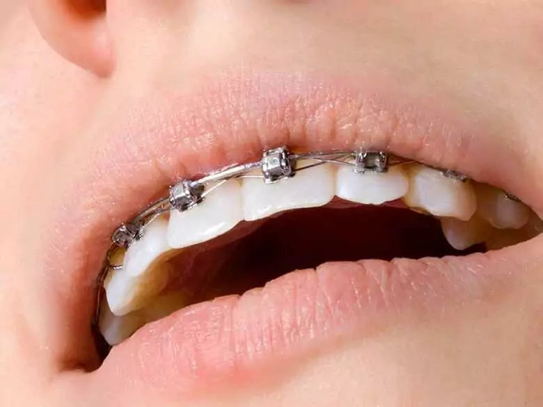 Diagnostyka wad zgryzu