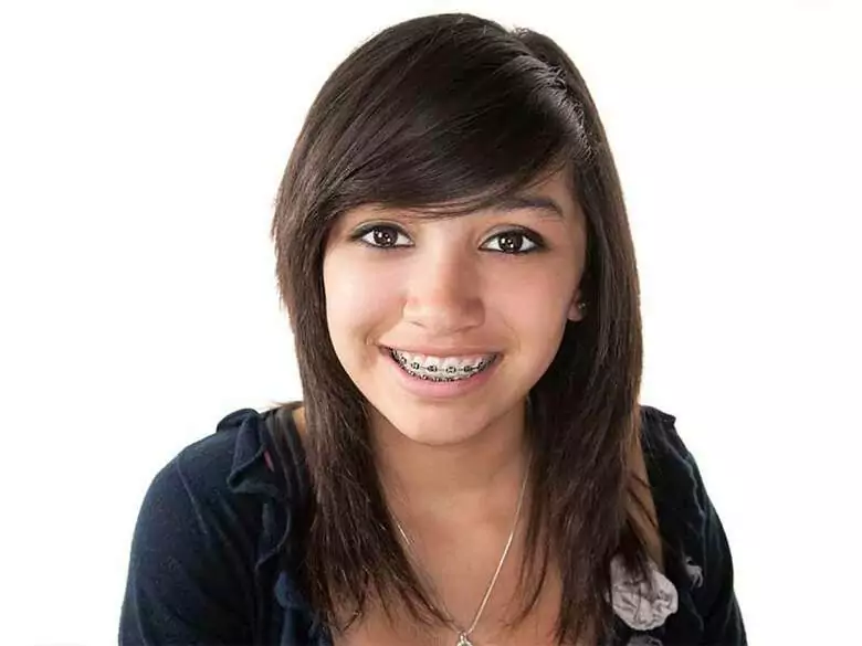 Aparaty na zęby - wszystko o aparatach na zęby