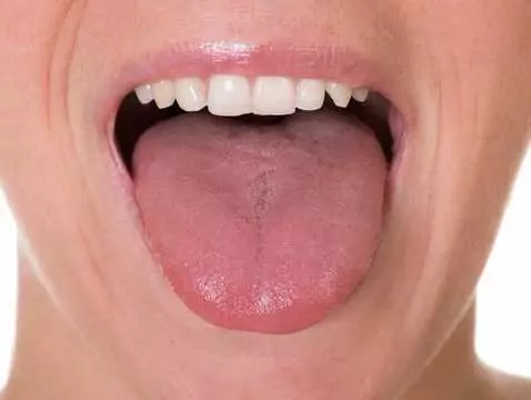 Podcięcie wędzidełka w jamie ustnej – kiedy jest konieczne?